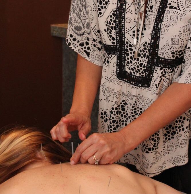 About Acupuncture: Ancient Healing for Modern Times