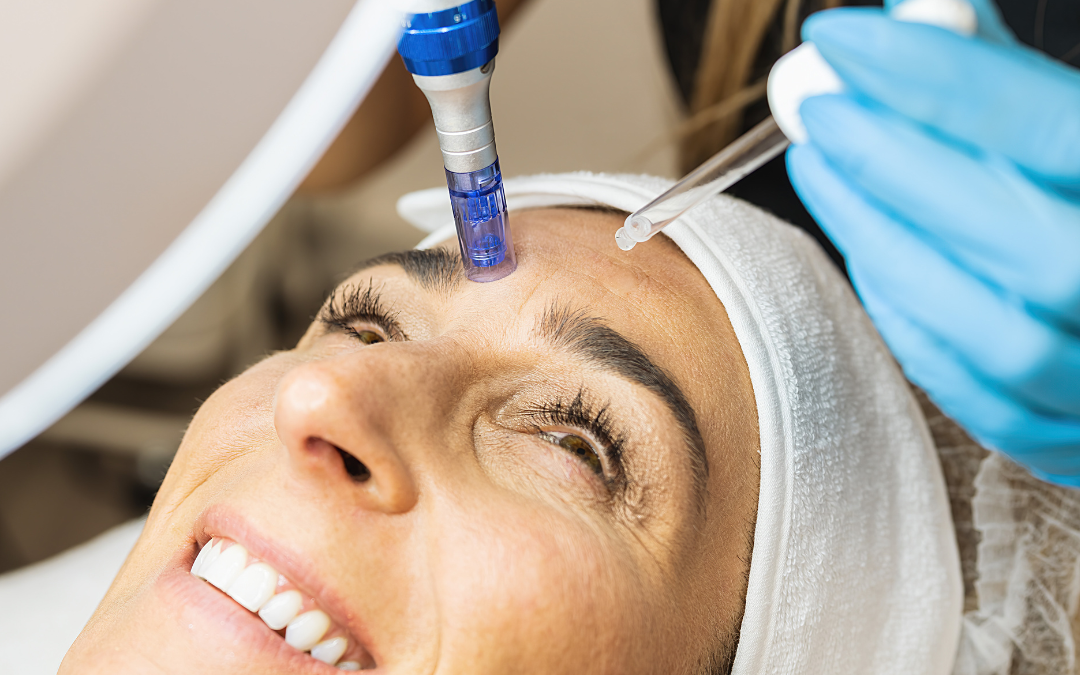 What is Microneedling? Face, Scars, Usage?